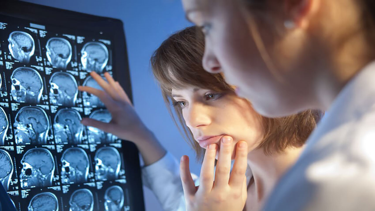 تصویر درمان سکته مغزی - دینا کلینیک