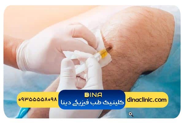 تزریق پی آر پی